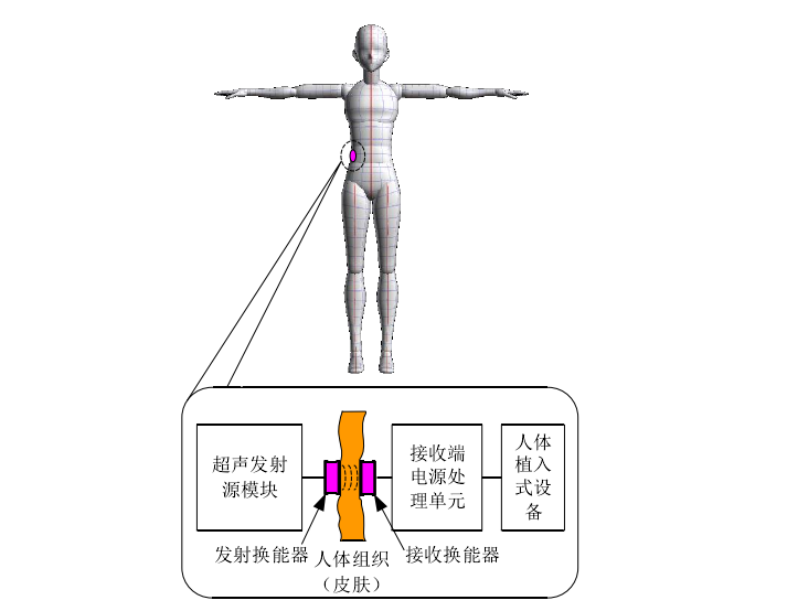植入式醫(yī)療設(shè)備超聲波耦合無線電能傳輸模型.png