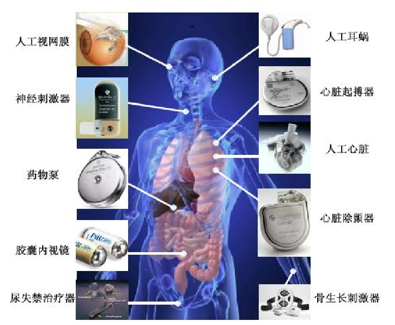 高壓放大器應(yīng)用植入式電子設(shè)備人體布圖.png